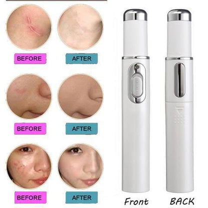 LovelyRLovely LovelyRLovely Blue Light Therapy Acne La LovelyRLovely Blue Light Therapy Acne+Wrinkle Laser Removal Treatment Device