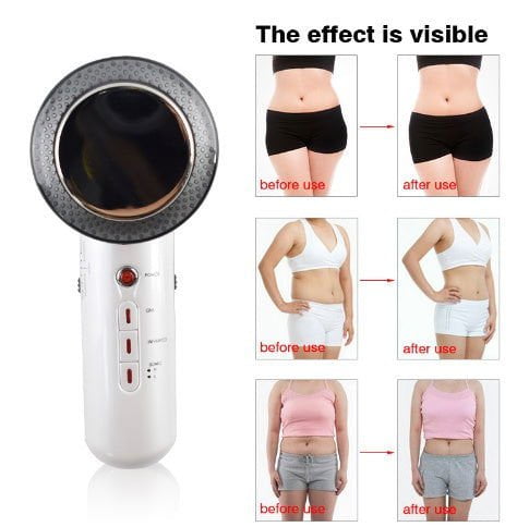 LovelyRLovely LovelyRLovely Handheld Ultrasound Body F LovelyRLovely Ultrasound Body Fat Remove Massager