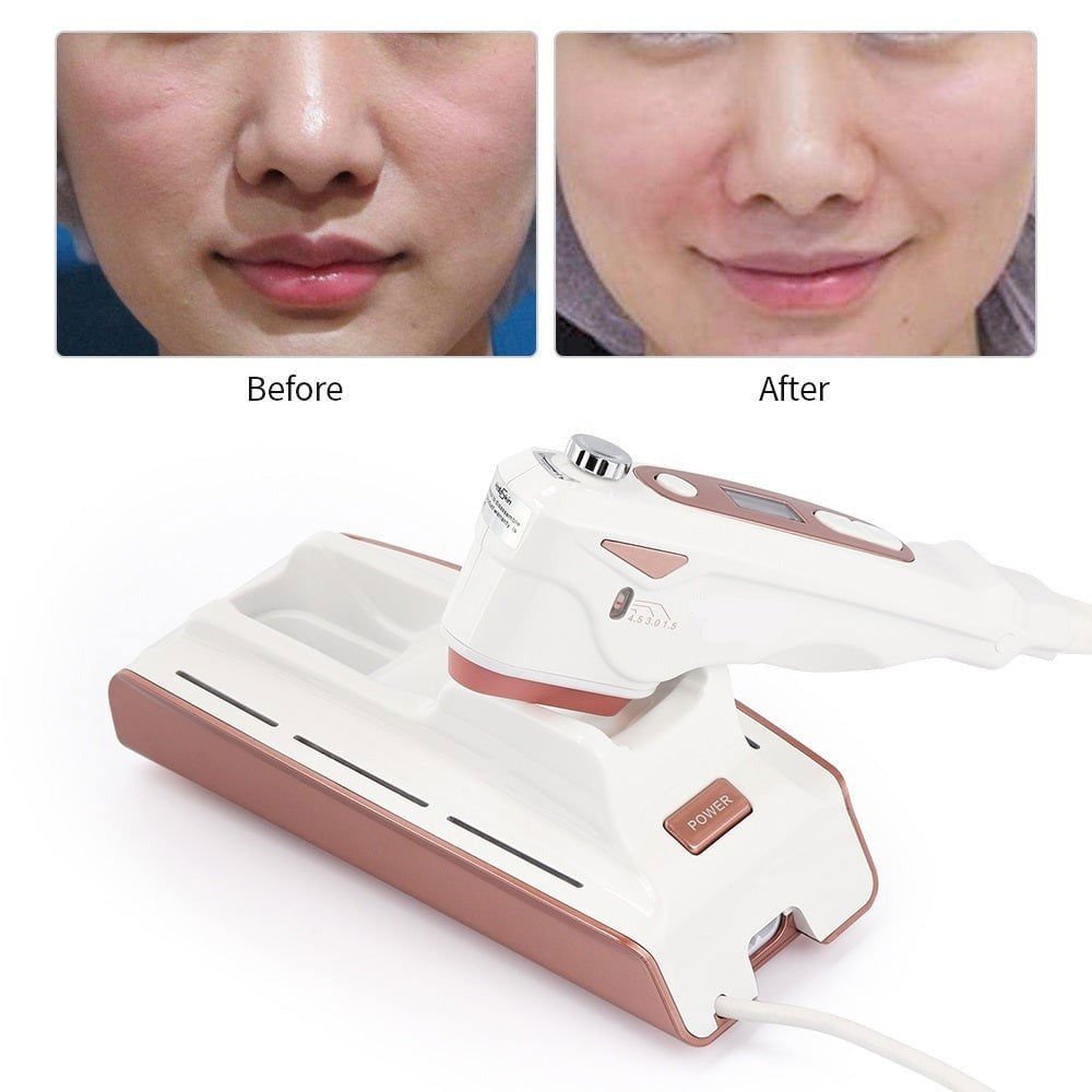 LovelyRLovely LovelyRLovely V Face Lifting Ultrasonic LovelyRLovely V Face Lifting Ultrasonic Anti-aging Beauty Instrument